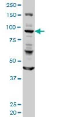 Western Blot: Golgin 97 Antibody (6G3) [H00002800-M01]