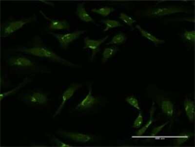 Immunocytochemistry/ Immunofluorescence: Golgin 97 Antibody [H00002800-D01P]
