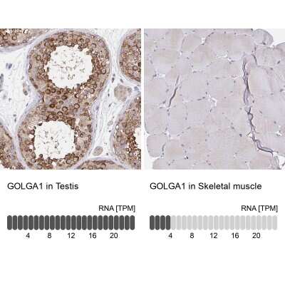 Immunohistochemistry-Paraffin: Golgin 97 Antibody [NBP2-38528]