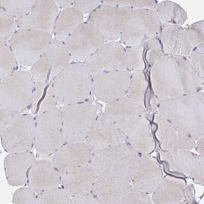 Immunohistochemistry-Paraffin: Golgin 97 Antibody [NBP2-38528]