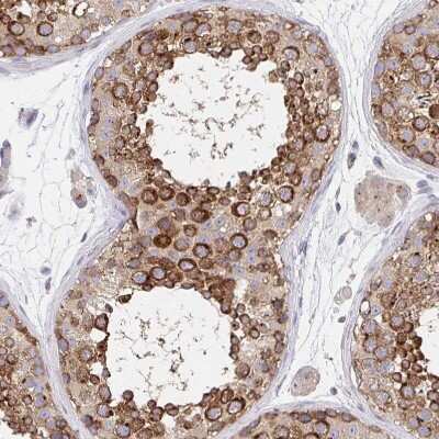Immunohistochemistry-Paraffin: Golgin 97 Antibody [NBP2-38528]