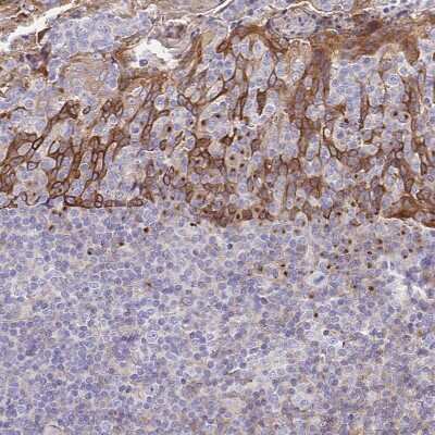 Immunohistochemistry-Paraffin: Golgin 97 Antibody [NBP2-38528]