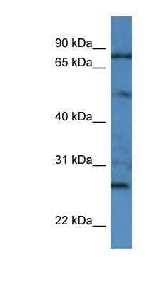 Western Blot: Golgin 97 Antibody [NBP1-79554]