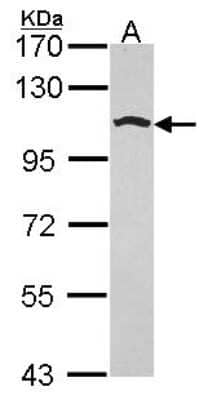 Western Blot: Golgin 97 Antibody [NBP2-16705]