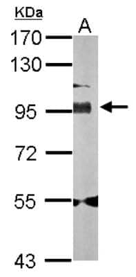 Western Blot: Golgin 97 Antibody [NBP2-16705]