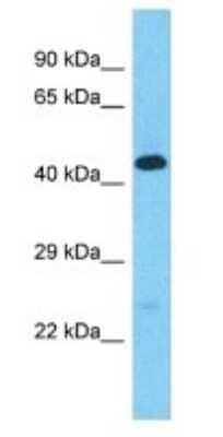 Western Blot: Golgin A6 Family-Like 2 Antibody [NBP3-09725]