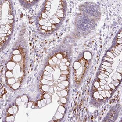 Immunohistochemistry-Paraffin: Golgin A8 Family, Member A Antibody [NBP2-55044]