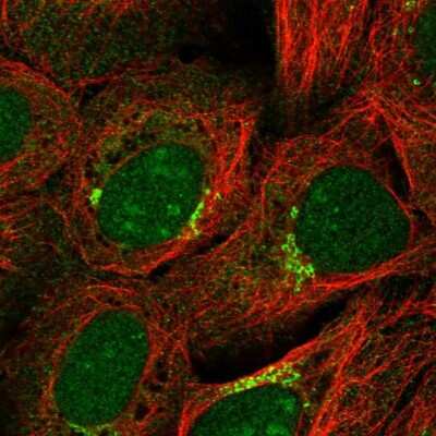 Immunocytochemistry/ Immunofluorescence: Gonadotropin Inducible Transcription Repressor 1 Antibody [NBP1-91956]