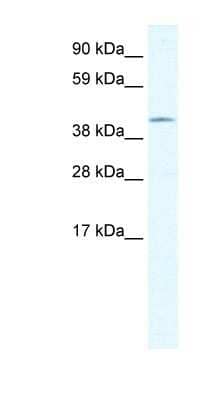 Western Blot: Gonadotropin Inducible Transcription Repressor 1 Antibody [NBP1-80177]