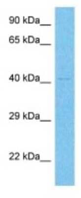 Western Blot: Gonadotropin Inducible Transcription Repressor 1 Antibody [NBP3-10529]