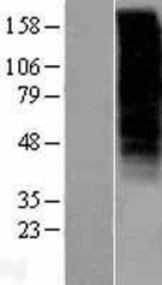 Western Blot: GnRHR Overexpression Lysate [NBL1-11192]