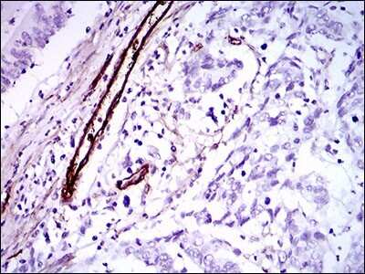 Immunohistochemistry: Goosecoid Antibody (4C5D5) - BSA Free [NBP2-37366]