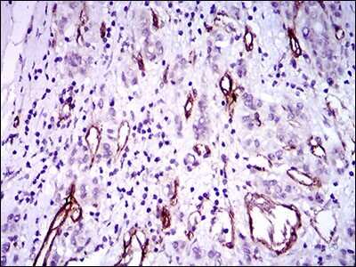 Immunohistochemistry: Goosecoid Antibody (4C5D5) - BSA Free [NBP2-37366]