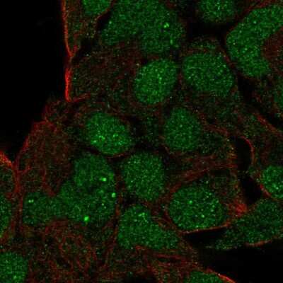 Immunocytochemistry/ Immunofluorescence: Goosecoid Antibody [NBP2-58820]