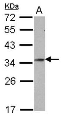 Western Blot: Goosecoid Antibody [NBP2-14972]