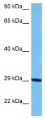 Western Blot: Goosecoid Antibody [NBP3-10106]