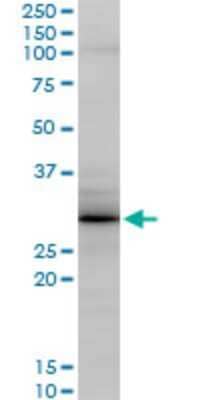 Western Blot: Grancalcin Antibody (2F11) [H00025801-M04]