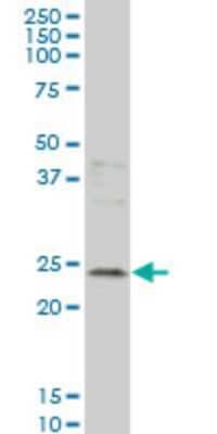 Western Blot: Grancalcin Antibody (2F5) [H00025801-M01]