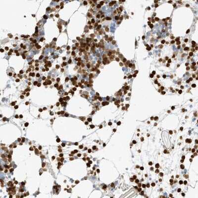 Immunohistochemistry-Paraffin: Grancalcin Antibody [NBP1-89785]