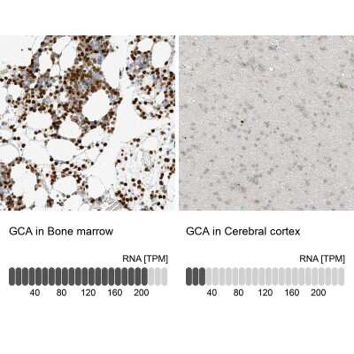 Immunohistochemistry-Paraffin: Grancalcin Antibody [NBP1-89785]