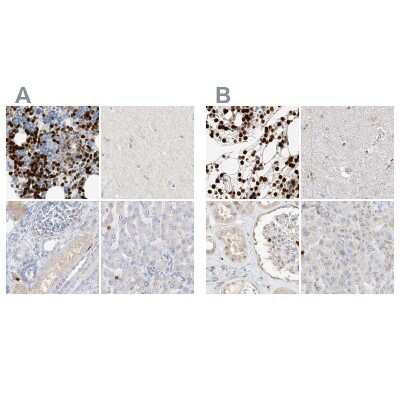 Immunohistochemistry-Paraffin: Grancalcin Antibody [NBP1-89785]