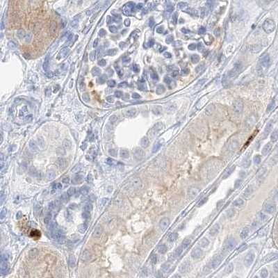 Immunohistochemistry-Paraffin: Grancalcin Antibody [NBP1-89785]