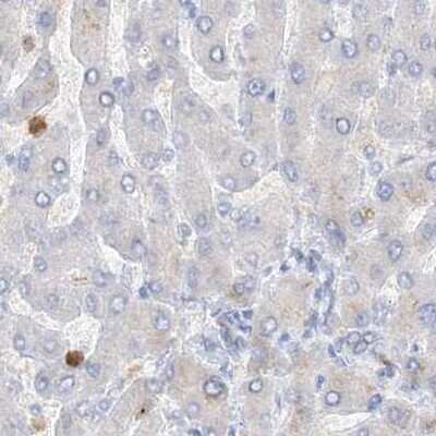 Immunohistochemistry-Paraffin: Grancalcin Antibody [NBP1-89785]