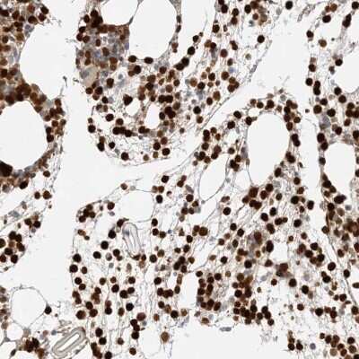 Immunohistochemistry-Paraffin: Grancalcin Antibody [NBP1-89786]