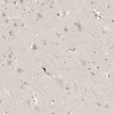 Immunohistochemistry-Paraffin: Grancalcin Antibody [NBP1-89786]