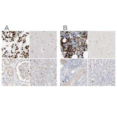 Immunohistochemistry-Paraffin: Grancalcin Antibody [NBP1-89786]