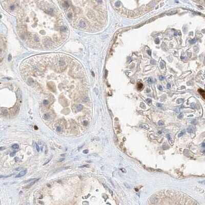 Immunohistochemistry-Paraffin: Grancalcin Antibody [NBP1-89786]