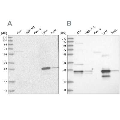 Western Blot: Grancalcin Antibody [NBP1-89785]