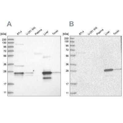 Western Blot: Grancalcin Antibody [NBP1-89786]