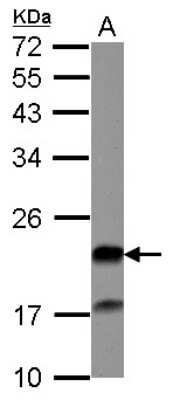 Western Blot: Grancalcin Antibody [NBP2-16734]