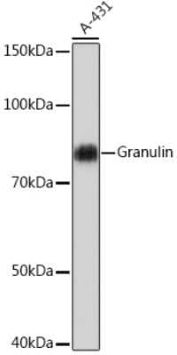 Western Blot: Granulin Antibody (8O5Q5) [NBP3-16566]