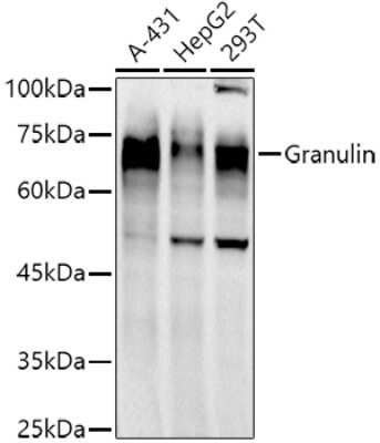 Western Blot: Granulin Antibody (0Q5Y2) [NBP3-16084]