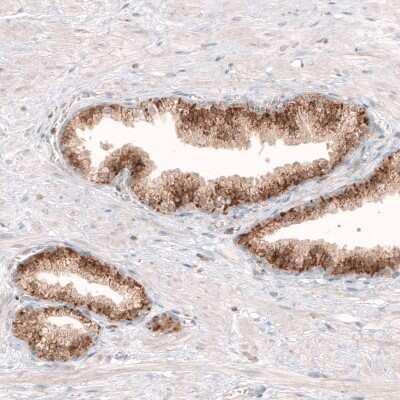 Immunohistochemistry-Paraffin: Granulin Antibody (CL5692) [NBP2-61424]