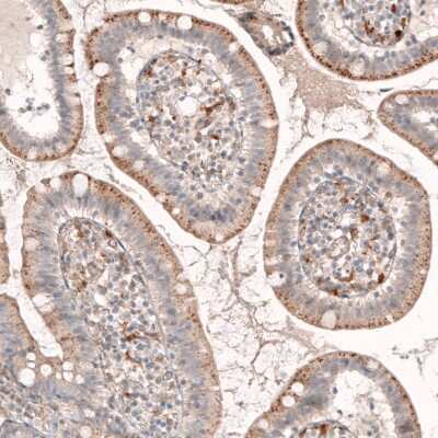Immunohistochemistry-Paraffin: Granulin Antibody (CL5692) [NBP2-61424]