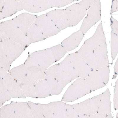 Immunohistochemistry-Paraffin: Granulin Antibody (CL5692) [NBP2-61424]