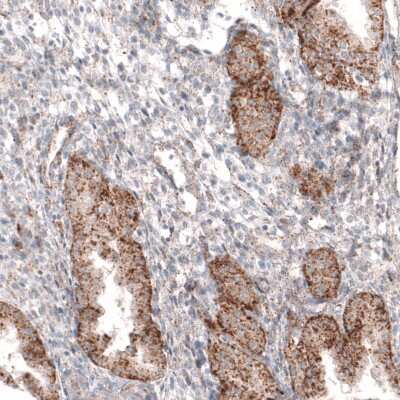 Immunohistochemistry-Paraffin: Granulin Antibody (CL5695) [NBP2-61425]