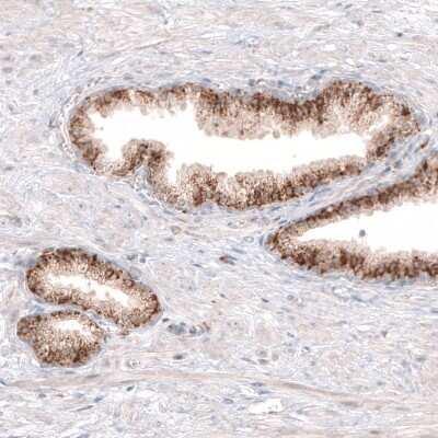 Immunohistochemistry-Paraffin: Granulin Antibody (CL5695) [NBP2-61425]
