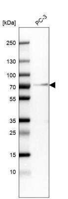 Western Blot: Granulin Antibody (CL5695) [NBP2-61425]