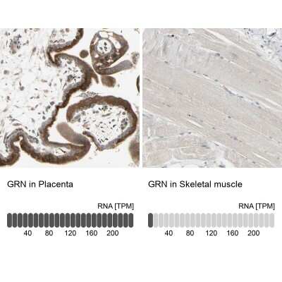 Immunohistochemistry-Paraffin: Granulin Antibody [NBP1-87324]