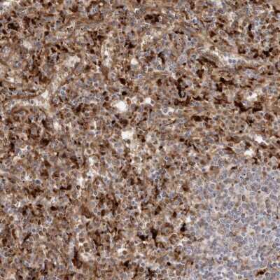 Immunohistochemistry-Paraffin: Granulin Antibody [NBP1-87325]