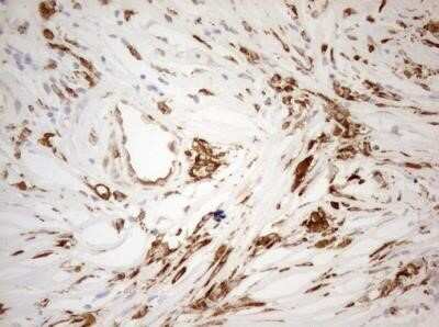 Immunohistochemistry: Granulin Antibody (OTI3H6) - Azide and BSA Free [NBP2-70847]