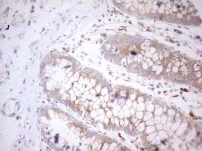 Immunohistochemistry: Granulin Antibody (OTI3H6) - Azide and BSA Free [NBP2-70847]