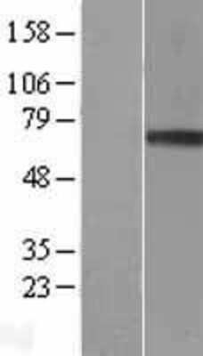 Western Blot: Granulin Overexpression Lysate [NBL1-11353]