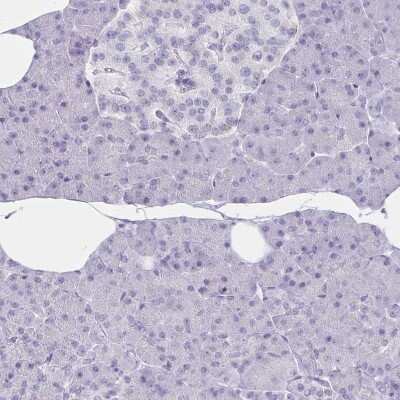 Immunohistochemistry-Paraffin: Granulysin Antibody [NBP2-38839]