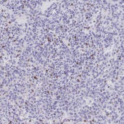 Immunohistochemistry-Paraffin: Granulysin Antibody [NBP2-38839]