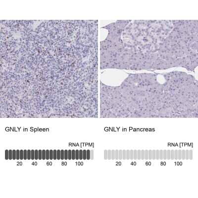 Immunohistochemistry-Paraffin: Granulysin Antibody [NBP2-38839]